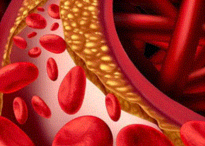 Photo of चुपके-चुपके आपका Cholesterol बढ़ा रहे हैं 5 Foods