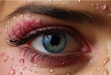 Photo of मानसून में बढ़ जाता है Eye Infection का खतरा