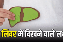 Photo of रात में नजर आते हैं Fatty Liver के ये 6 लक्षण