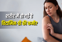 Photo of स्किन पर दिखने वाले ये 6 लक्षण करते हैं विटामिन-डी की कमी का इशारा