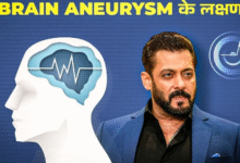 Photo of क्या है Brain Aneurysm, जिससे जूझ रहे हैं बॉलीवुड एक्‍टर Salman Khan