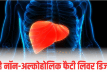Photo of शराब नहीं पीते हैं? फ‍िर भी हो सकता है Fatty Liver; जानें क्‍यों साइलेंट क‍िलर बन रही ये बीमारी