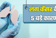 Photo of सिर्फ स्मोकिंग करने वालों की बीमारी नहीं है लंग कैंसर, ये 5 कारण भी हैं जानलेवा