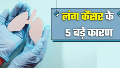 Photo of सिर्फ स्मोकिंग करने वालों की बीमारी नहीं है लंग कैंसर, ये 5 कारण भी हैं जानलेवा