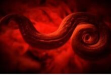 Photo of जानलेवा हो सकते हैं शरीर में छिपे 5 Parasites