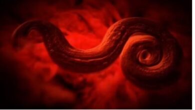 Photo of जानलेवा हो सकते हैं शरीर में छिपे 5 Parasites