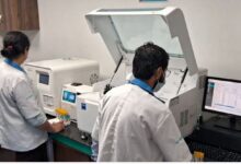 Photo of हिमाचल: आदर्श अस्पतालों में होंगे 350 टेस्ट, डिजिटल एक्सरे