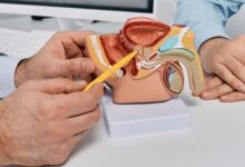 Photo of विटामिन डी की कमी से पुरुषों में बढ़ जाता है प्रोस्टेट कैंसर का खतरा