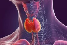 Photo of थायराइड रोगी भूलकर भी न करें इन चार चीजों का सेवन