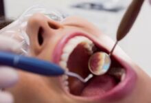 Photo of खराब ओरल हेल्थ कैसे बनती है बड़ी बीमारियों की वजह