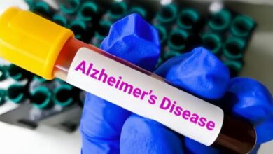Photo of लक्षण दिखने से 10 साल पहले ही पता चल सकेगा अल्जाइमर का खतरा
