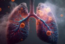 Photo of फेफड़ों से जुड़े ये चार लक्षण भूलकर भी न करें नजरअंदाज