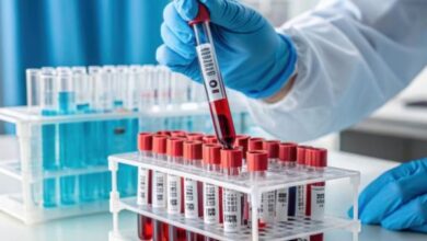 Photo of जम्मू में रोजाना पड़ रही 250 यूनिट खून की जरूरत