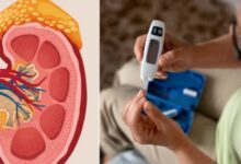 Photo of डायबिटीज रोगी हो जाएं सावधान, शुगर कंट्रोल नहीं तो आपकी किडनी भी खतरे में